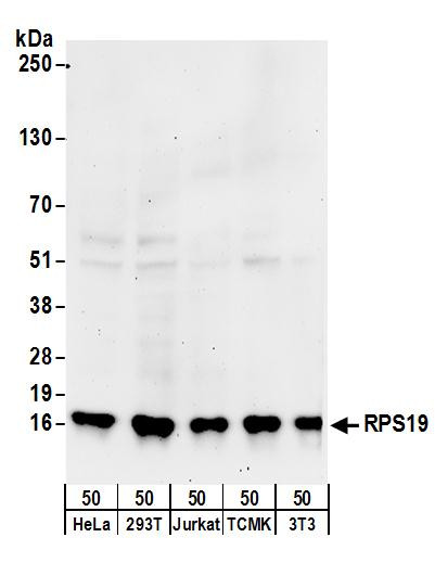 RPS19 Antibody in Western Blot (WB)