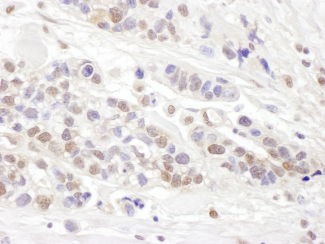 TCEB2 Antibody in Immunohistochemistry (Paraffin) (IHC (P))