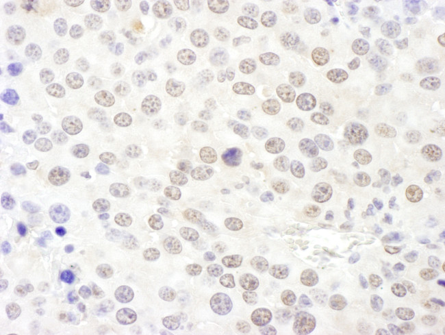 NHP2L1 Antibody in Immunohistochemistry (Paraffin) (IHC (P))