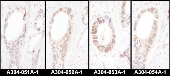 HNF1-alpha Antibody in Immunohistochemistry (Paraffin) (IHC (P))