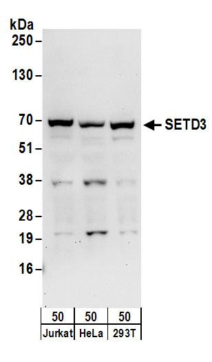 SETD3 Antibody in Western Blot (WB)