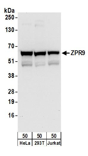 ZPR9 Antibody in Western Blot (WB)