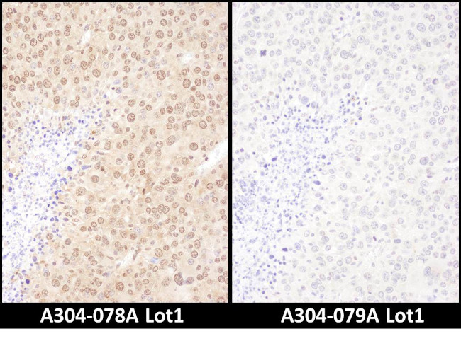 WWOX Antibody in Immunohistochemistry (Paraffin) (IHC (P))