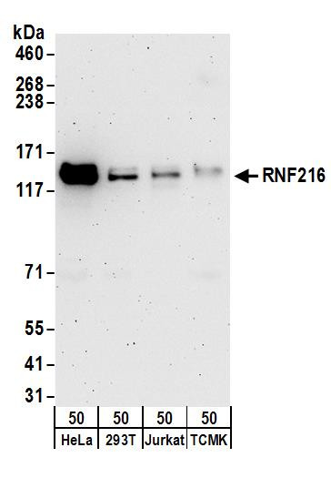 RNF216 Antibody in Western Blot (WB)