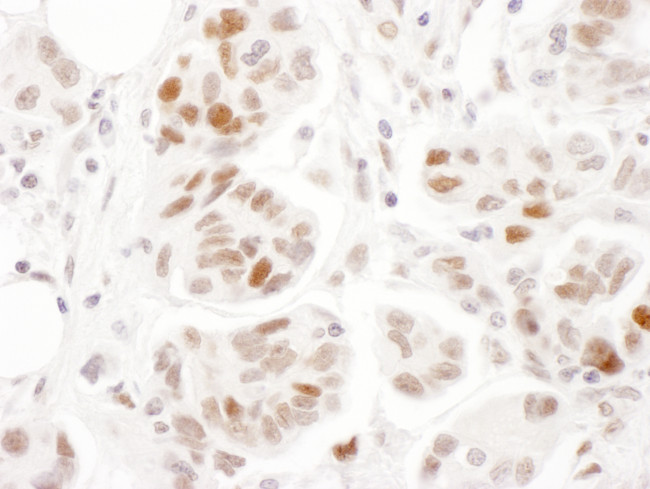 Phospho-SMC1 (Ser957) Antibody in Immunohistochemistry (Paraffin) (IHC (P))