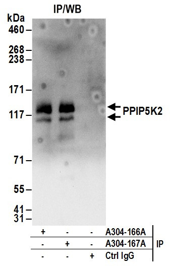 PPIP5K2 Antibody in Immunoprecipitation (IP)