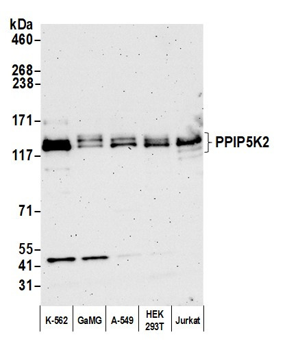 PPIP5K2 Antibody in Western Blot (WB)