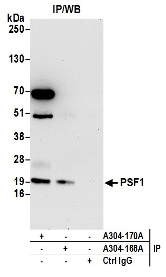 PSF1 Antibody in Immunoprecipitation (IP)