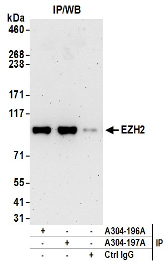 EZH2 Antibody in Immunoprecipitation (IP)