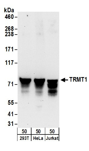 TRMT1 Antibody in Western Blot (WB)