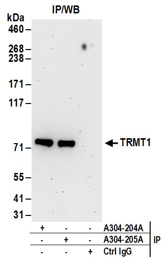 TRMT1 Antibody in Immunoprecipitation (IP)