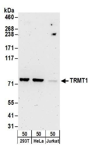 TRMT1 Antibody in Western Blot (WB)