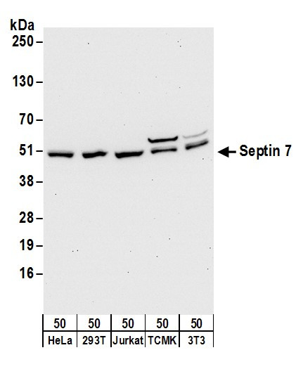 Septin 7 Antibody in Western Blot (WB)