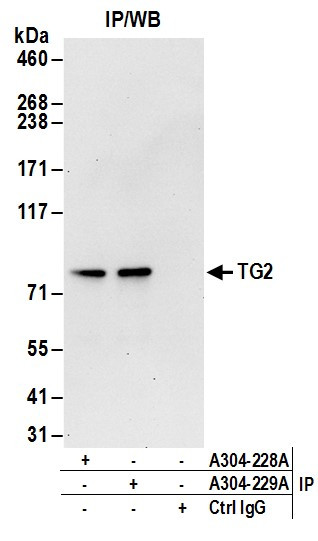 TG2 Antibody in Immunoprecipitation (IP)