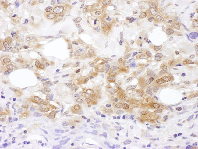 MKK7 Antibody in Immunohistochemistry (Paraffin) (IHC (P))