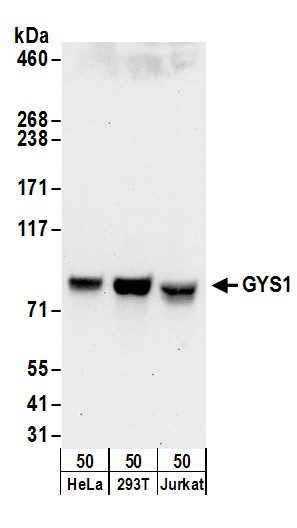 GYS1 Antibody in Western Blot (WB)