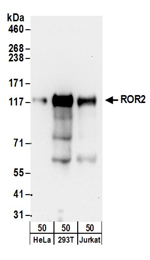 ROR2 Antibody in Western Blot (WB)