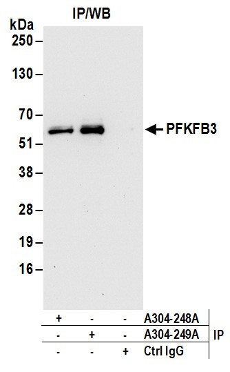 PFKFB3 Antibody in Immunoprecipitation (IP)