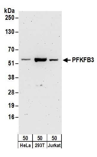 PFKFB3 Antibody in Western Blot (WB)