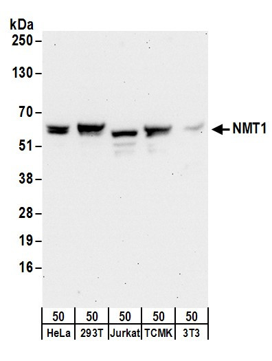 NMT1 Antibody in Western Blot (WB)