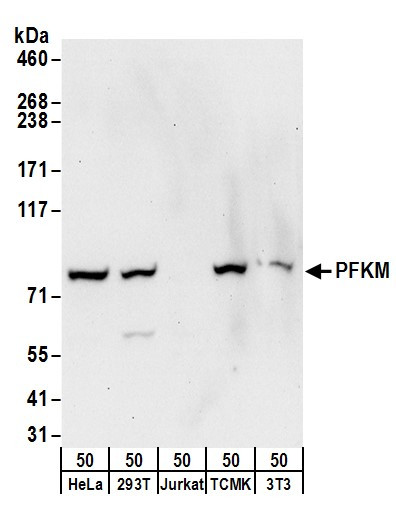 PFKM Antibody in Western Blot (WB)