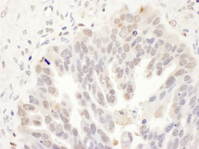 DCK Antibody in Immunohistochemistry (Paraffin) (IHC (P))