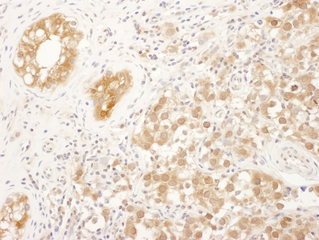 FNTA Antibody in Immunohistochemistry (Paraffin) (IHC (P))