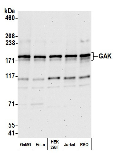 GAK Antibody in Western Blot (WB)