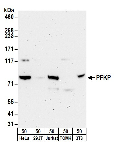 PFKP Antibody in Western Blot (WB)