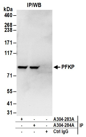 PFKP Antibody in Immunoprecipitation (IP)