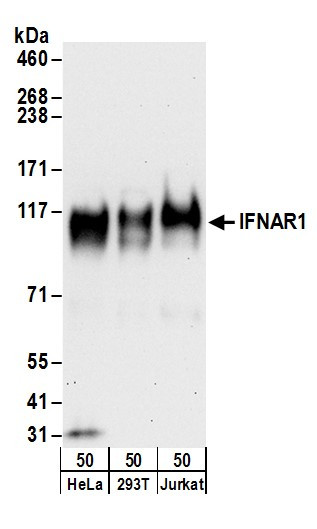 IFNAR1 Antibody in Western Blot (WB)