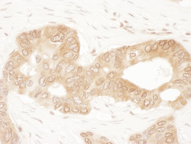 ACAT2 Antibody in Immunohistochemistry (Paraffin) (IHC (P))