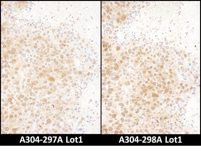 RAN Antibody in Immunohistochemistry (Paraffin) (IHC (P))