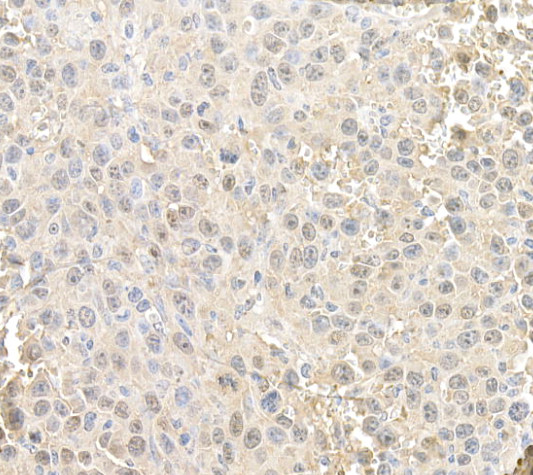 RAN Antibody in Immunohistochemistry (Paraffin) (IHC (P))