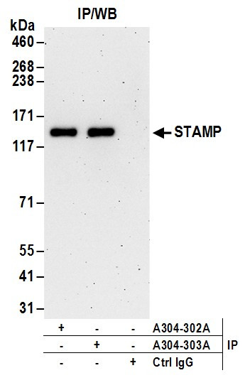 STAMP Antibody in Immunoprecipitation (IP)