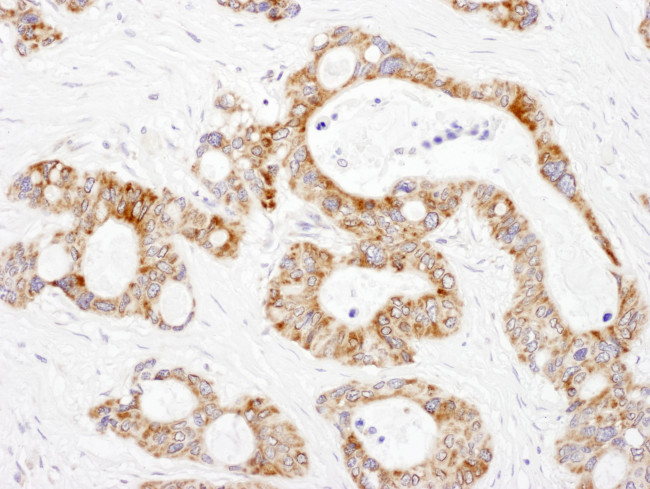 DLST Antibody in Immunohistochemistry (Paraffin) (IHC (P))