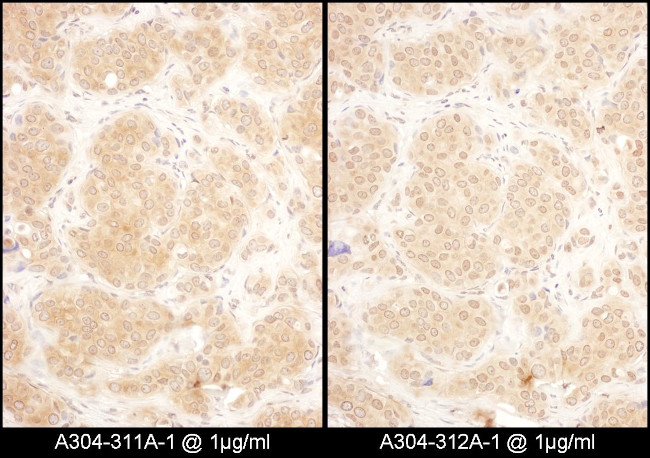 GART Antibody in Immunohistochemistry (Paraffin) (IHC (P))