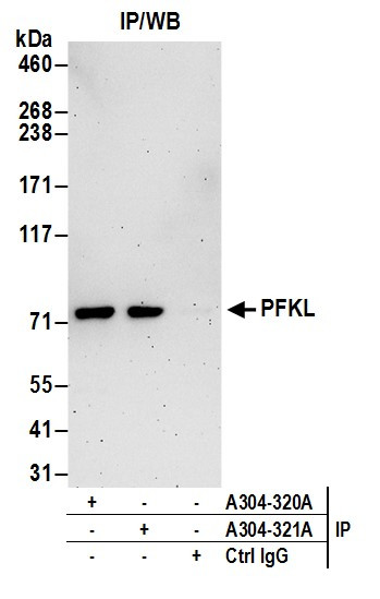 PFKL Antibody in Immunoprecipitation (IP)