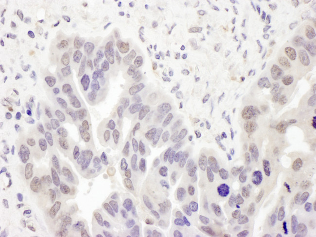 PolD2 Antibody in Immunohistochemistry (Paraffin) (IHC (P))