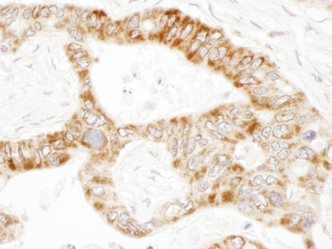 PCCA Antibody in Immunohistochemistry (Paraffin) (IHC (P))