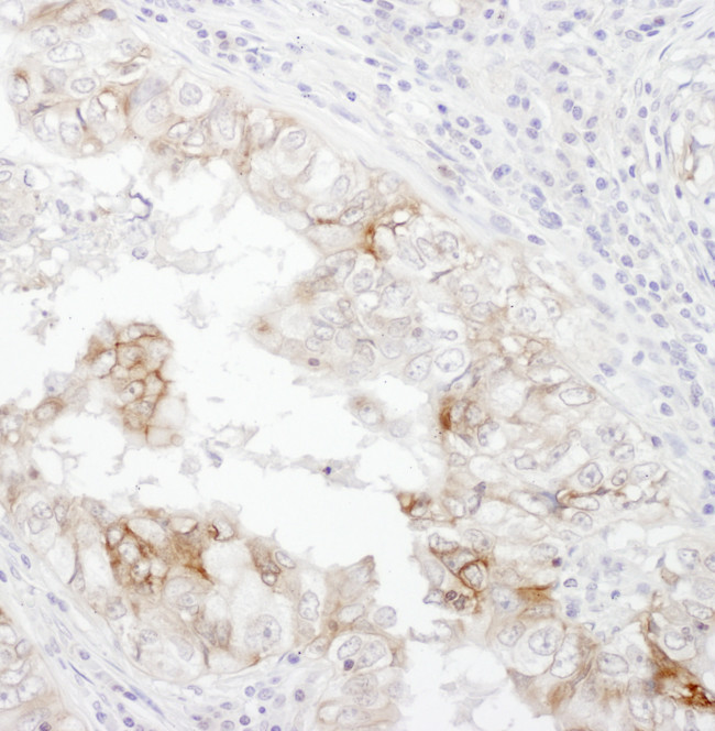 CD98 Antibody in Immunohistochemistry (Paraffin) (IHC (P))