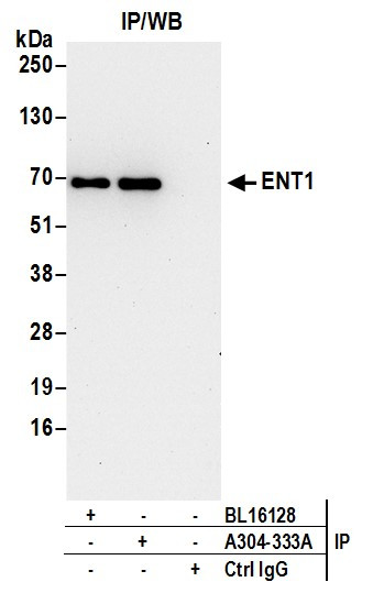 ENT1 Antibody in Immunoprecipitation (IP)