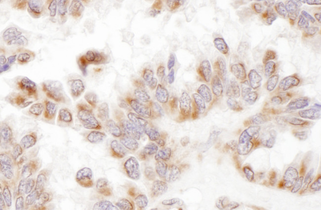 Presenilin-2 Antibody in Immunohistochemistry (Paraffin) (IHC (P))