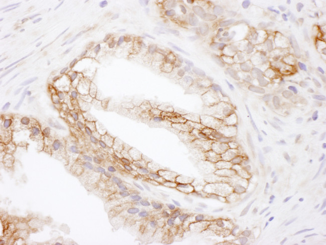 MCT1 Antibody in Immunohistochemistry (Paraffin) (IHC (P))