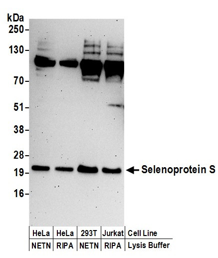 Selenoprotein S Antibody in Western Blot (WB)