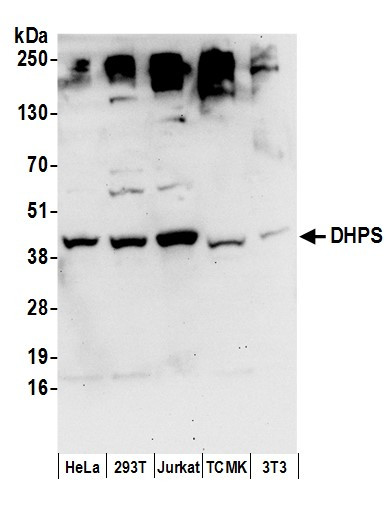 DHPS Antibody in Western Blot (WB)