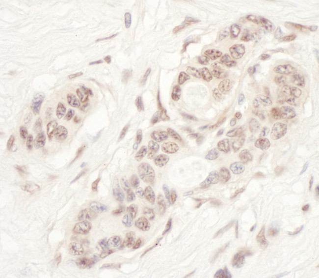 NAT10 Antibody in Immunohistochemistry (Paraffin) (IHC (P))