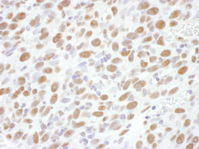 Phospho-RNA Polymerase II (Ser2) Antibody in Immunohistochemistry (Paraffin) (IHC (P))