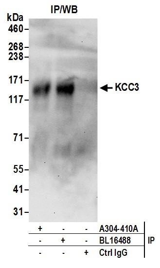 KCC3 Antibody in Immunoprecipitation (IP)