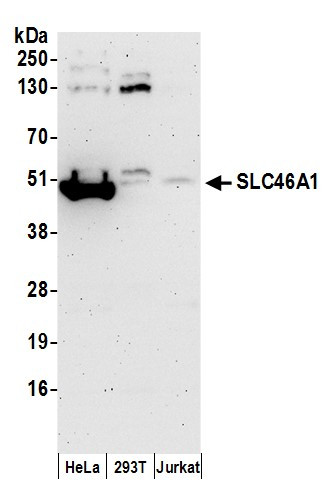 SLC46A1 Antibody in Western Blot (WB)